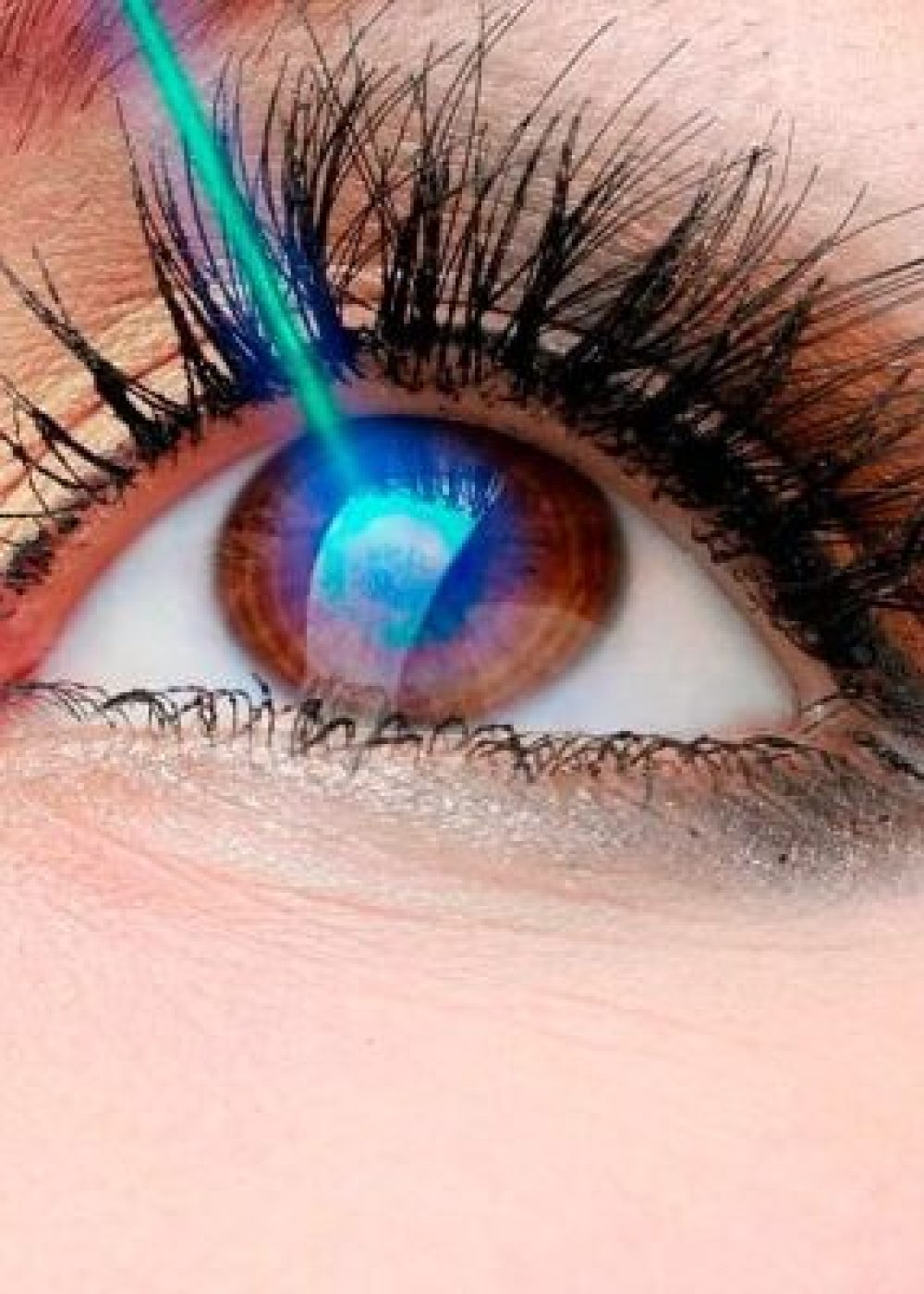 45720_cirurgia-refrativa-casos-indicados-blog-jpg